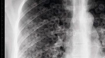 Radiografía 1 (detalle)_Javier Glez. Vega_IN____ABLE